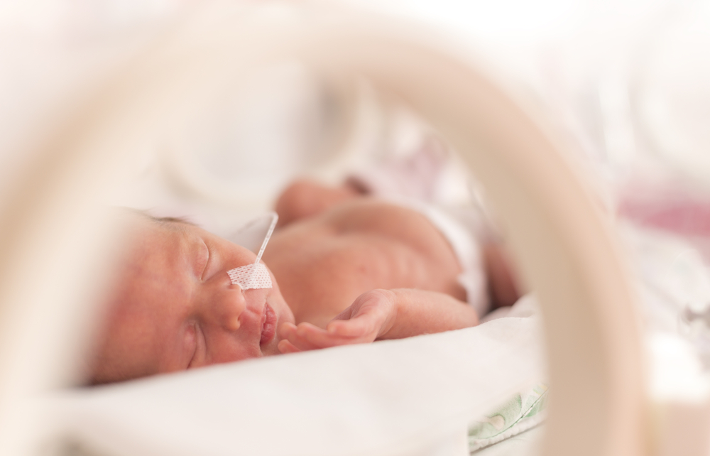epatite neonatale